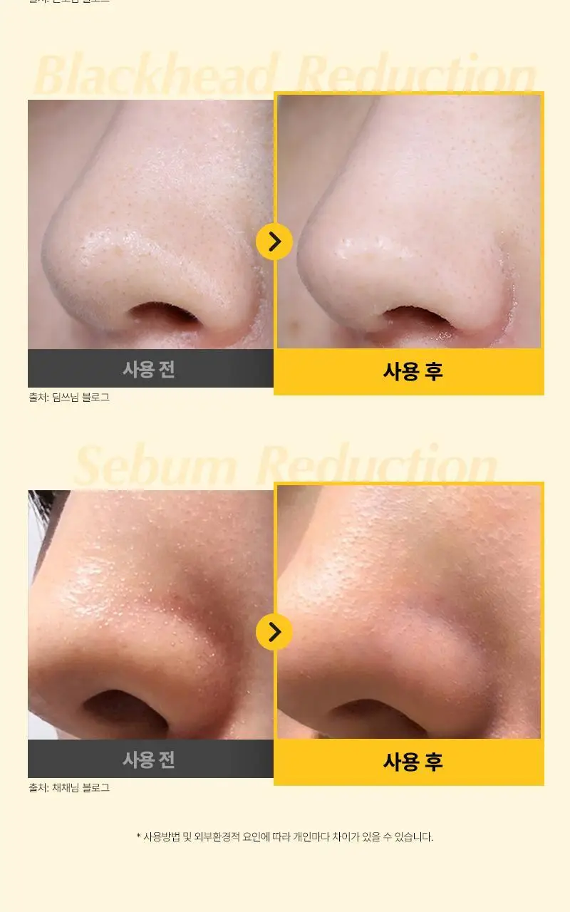 [화잘먹/민감결케어] 한스킨 클렌징오일&블랙헤드 PHA 200ml 더블 기획 (+30ml) 상세페이지 17